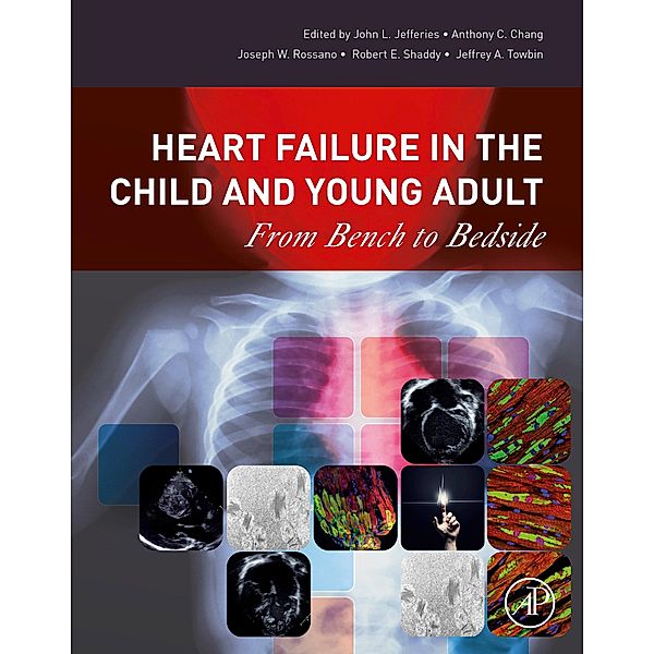 Heart Failure in the Child and Young Adult