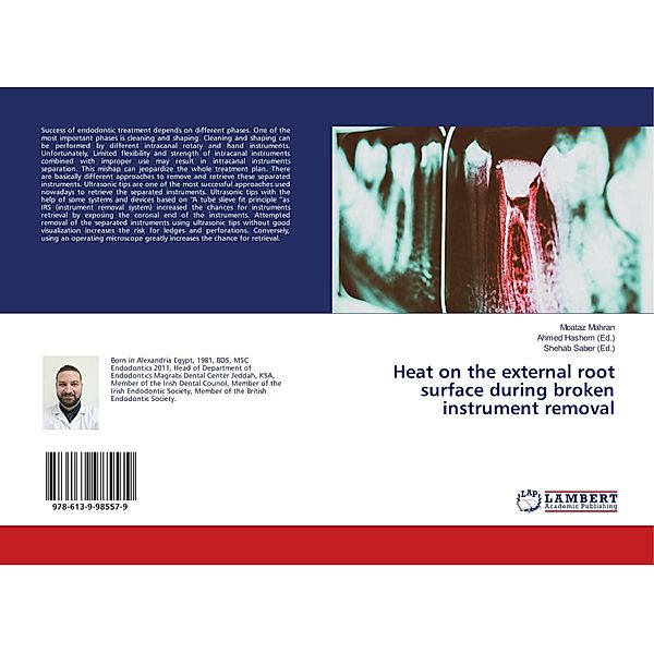 Heat on the external root surface during broken instrument removal, Moataz Mahran