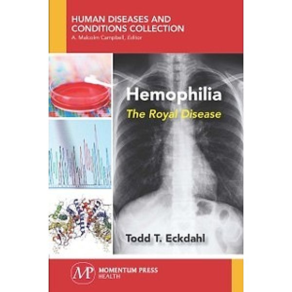 Hemophilia, Todd Eckdahl