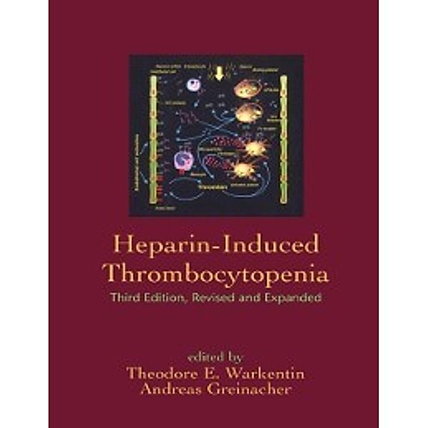 Heparin-Induced Thrombocytopenia