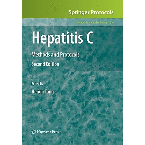 Hepatitis C