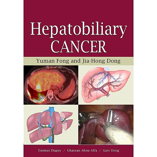 Hepatobiliary Cancer, Yuman Fong