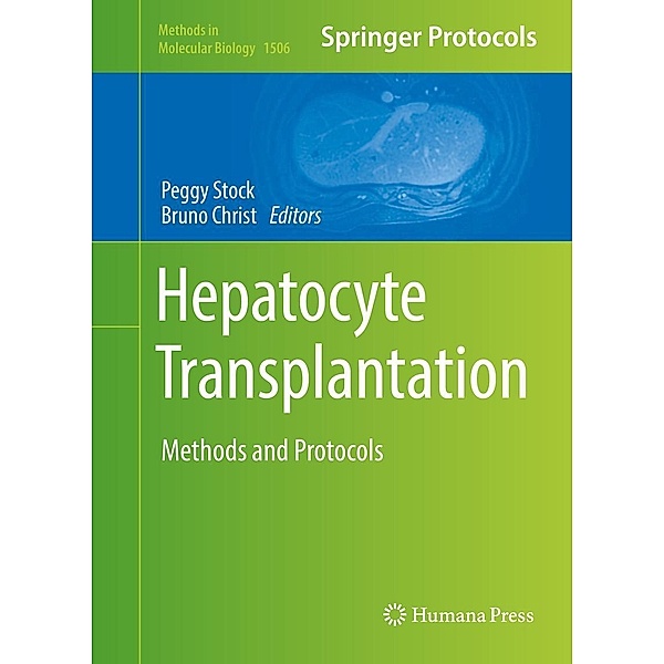 Hepatocyte Transplantation / Methods in Molecular Biology Bd.1506