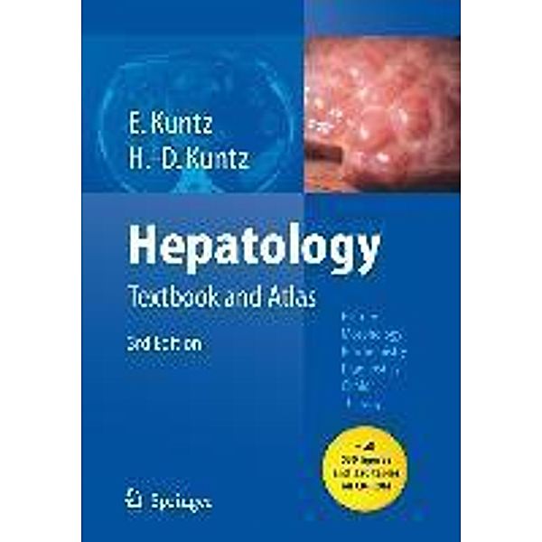 Hepatology, Erwin Kuntz, Hans-Dieter Kuntz