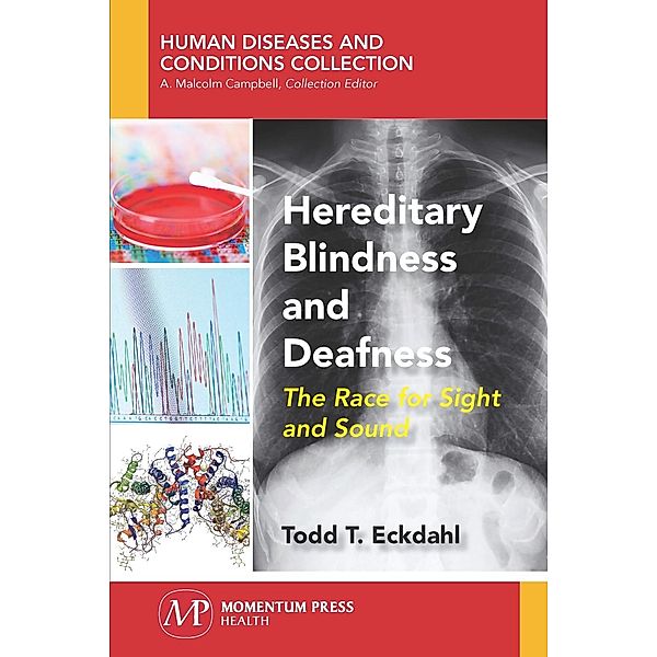 Hereditary Blindness and Deafness, Todd T. Eckdahl