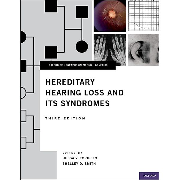 Hereditary Hearing Loss and Its Syndromes / Oxford Monographs on Medical Genetics Bd..