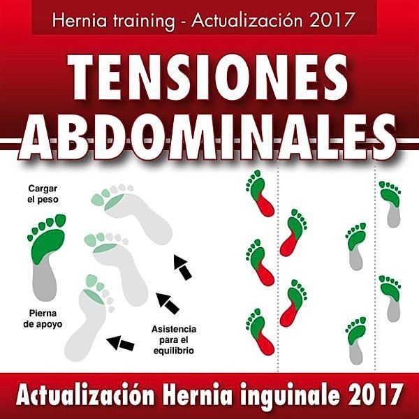 Hernia inguinal - Actualización 2017, Gustavo Guglielmotti