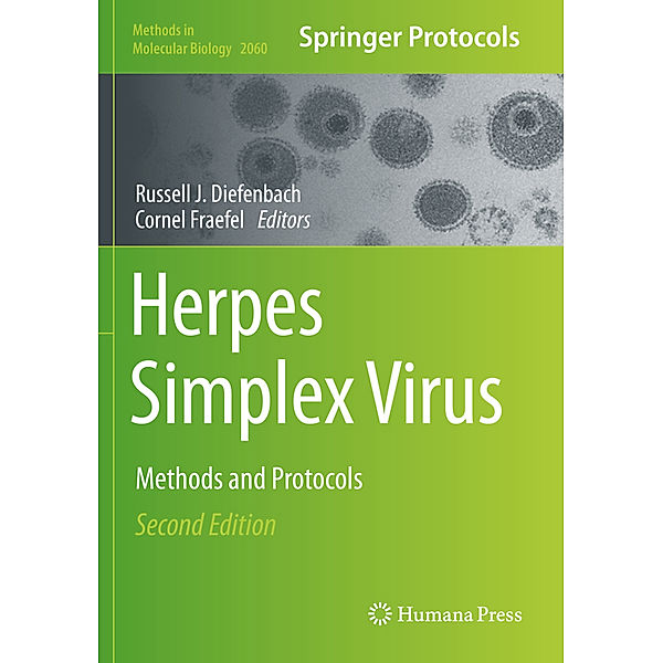 Herpes Simplex Virus