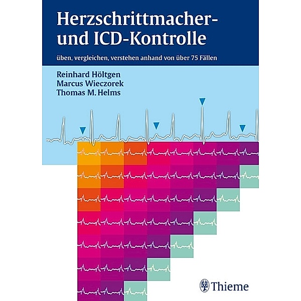 Herzschrittmacher- und ICD-Kontrolle, Reinhard Höltgen, Marcus Wieczorek, Thomas M. Helms