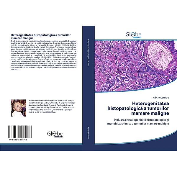 Heterogenitatea histopatologica a tumorilor mamare maligne, Adrian Dumitru