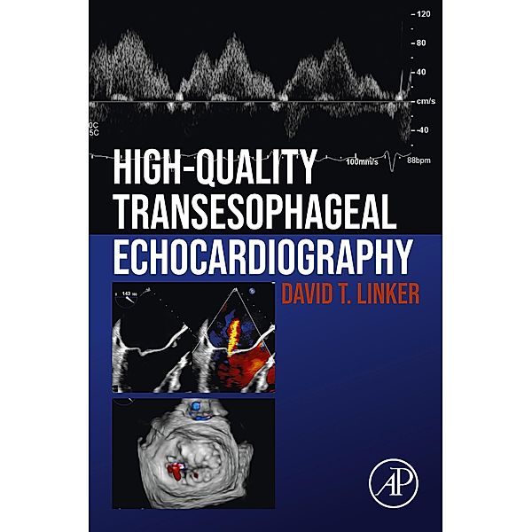 High-Quality Transesophageal Echocardiography, David T. Linker