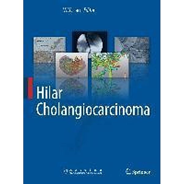 Hilar Cholangiocarcinoma