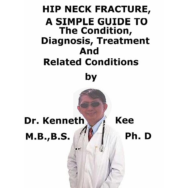 Hip Neck Fracture, A Simple Guide To The Condition, Diagnosis, Treatment And Related Conditions, Kenneth Kee