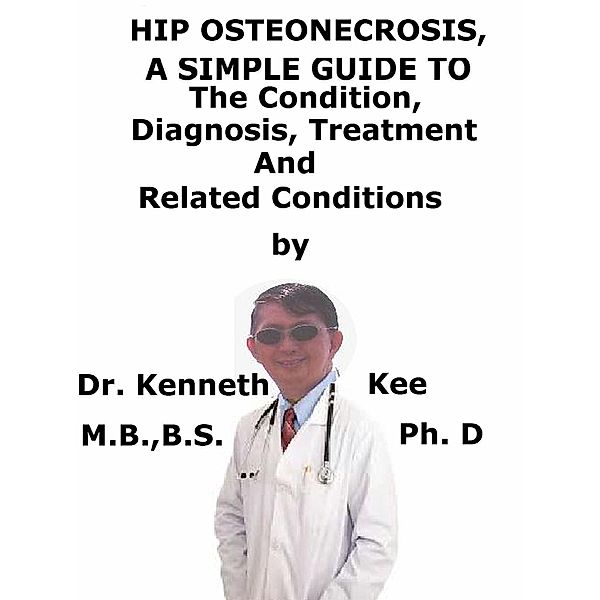 Hip Osteonecrosis A Simple Guide To The Condition, Diagnosis, Treatment And Related Conditions, Kenneth Kee