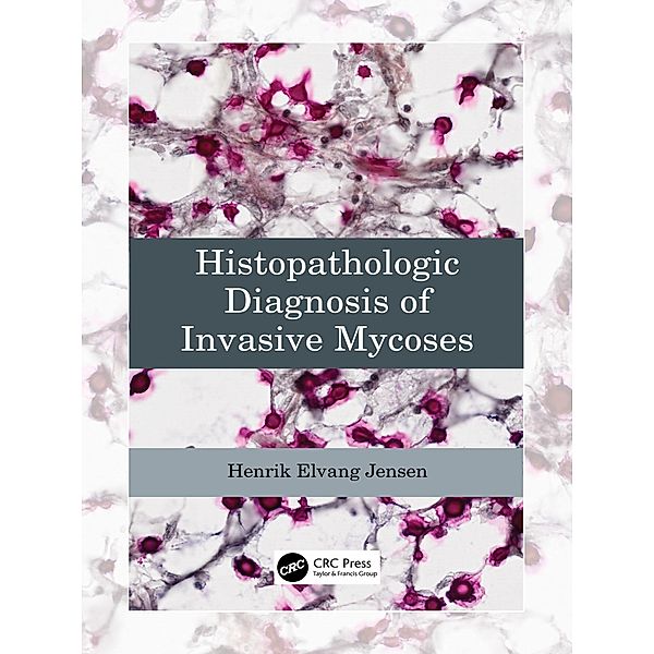 Histopathologic Diagnosis of Invasive Mycoses, Henrik Elvang Jensen