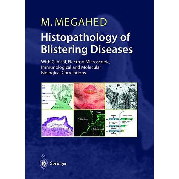 Histopathology of Blistering Diseases, Mosaad Megahed