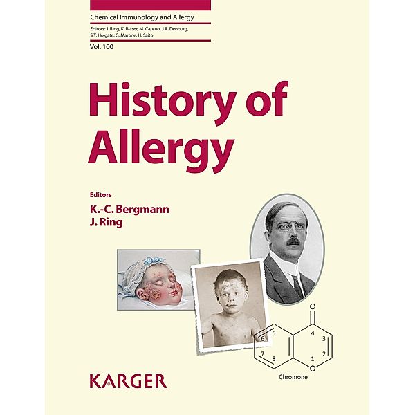 History of Allergy