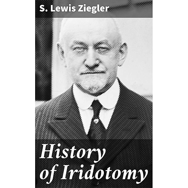 History of Iridotomy, S. Lewis Ziegler