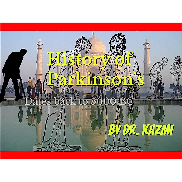 History Of  Parkinson's Disease, M. A. Dr. Kazmi