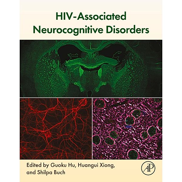 HIV-Associated Neurocognitive Disorders