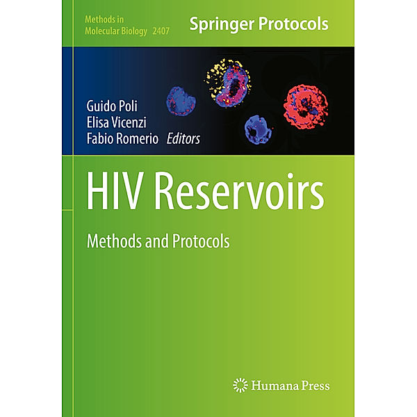 HIV Reservoirs