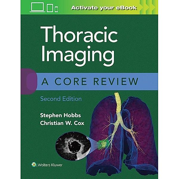 Hobbs, S: Thoracic Imaging: A Core Review, Stephen Hobbs