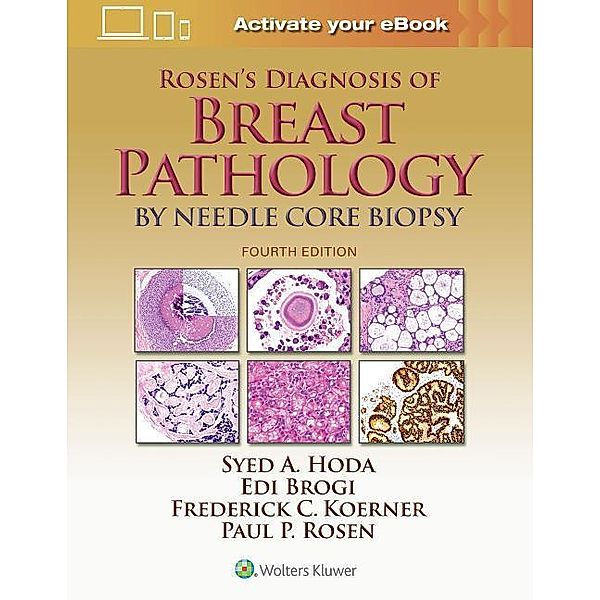 Hoda: Rosen's Diagnosis of Breast Pathology by Needle, Syed A. Hoda, Paul Peter Rosen, Edi Brogi