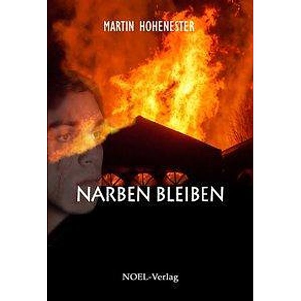 Hohenester, M: Narben bleiben, Martin Hohenester