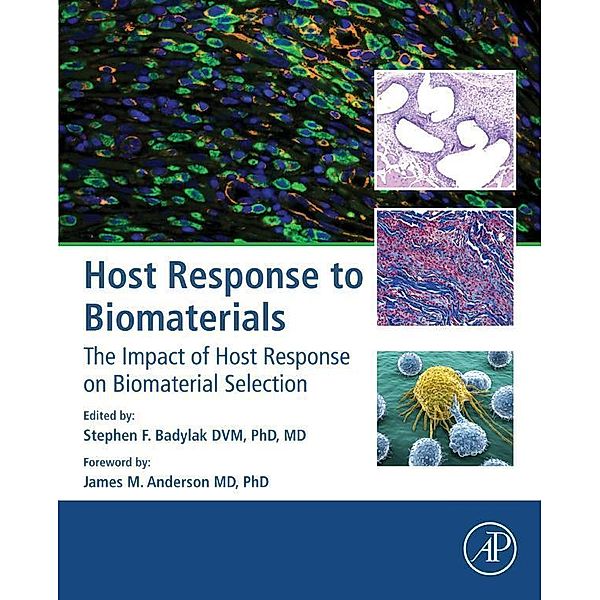 Host Response to Biomaterials