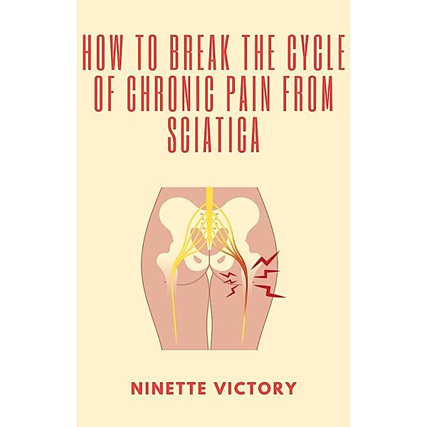 How to Break the Cycle of Chronic Pain from Sciatica, Ninette Victory