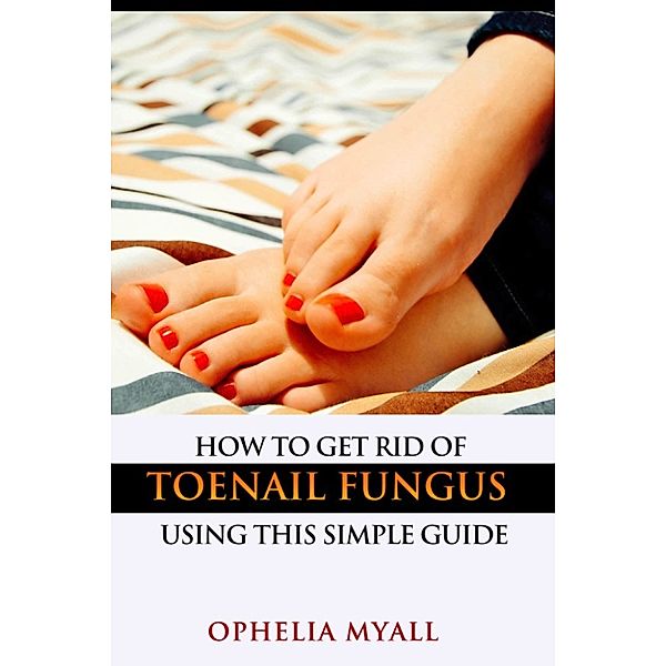 How to Get Rid of Toenail Fungus Using This Simple Guide, Ophelia Myall