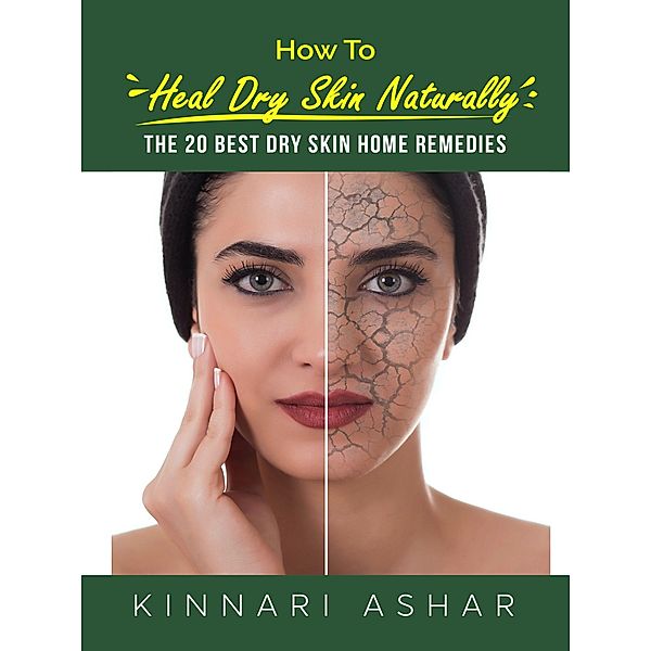 How to Heal Dry Skin Naturally (Natural Skin Care) / Natural Skin Care, Kinnari Ashar