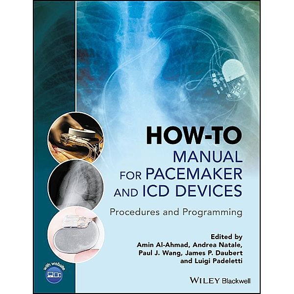 How-to Manual for Pacemaker and ICD Devices