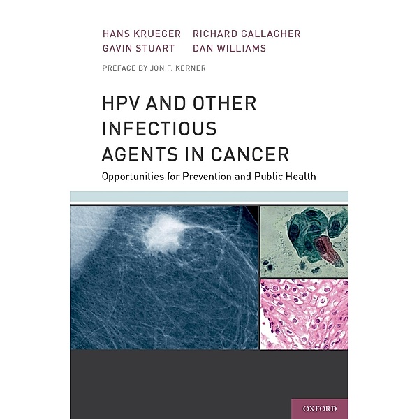 HPV and Other Infectious Agents in Cancer, Hans Krueger, Gavin Stuart, Richard Gallagher, Dan Williams