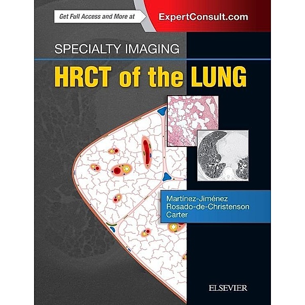 HRCT of the Lung, Santiago Martínez-Jiménez