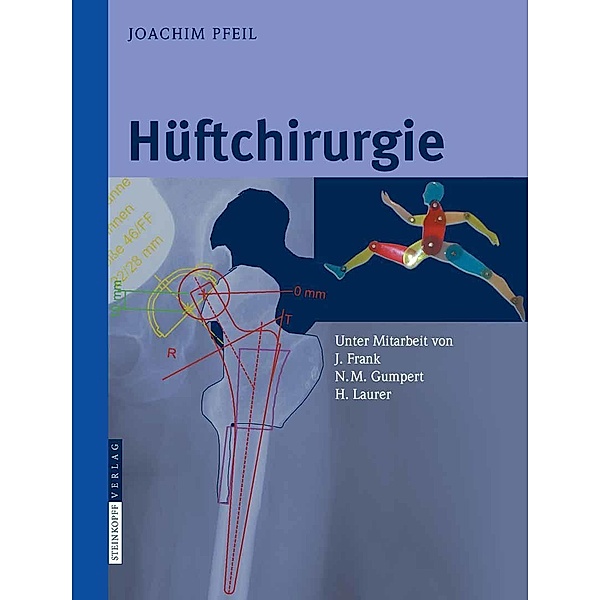 Hüftchirurgie, Joachim Pfeil