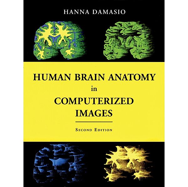 Human Brain Anatomy in Computerized Images, Hanna M. D. Damasio