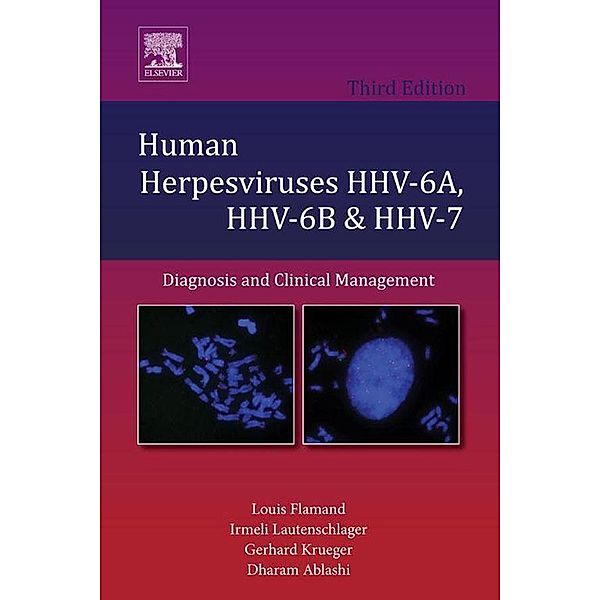 Human Herpesviruses HHV-6A, HHV-6B and HHV-7