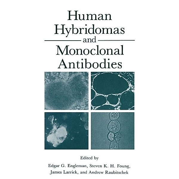 Human Hybridomas and Monoclonal Antibodies