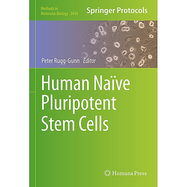Human Naïve Pluripotent Stem Cells