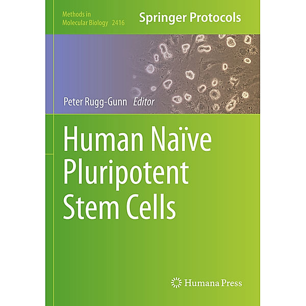 Human Naïve Pluripotent Stem Cells