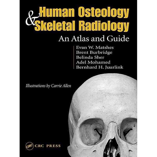 Human Osteology and Skeletal Radiology, Evan W. Matshes, Bernard Juurlink