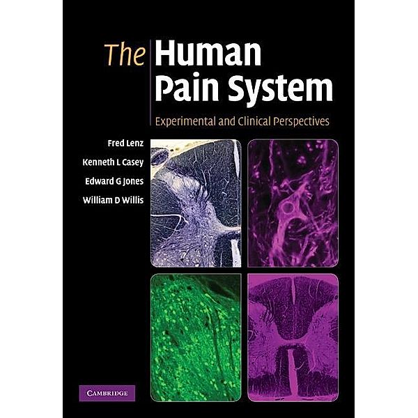 Human Pain System, Frederick A. Lenz
