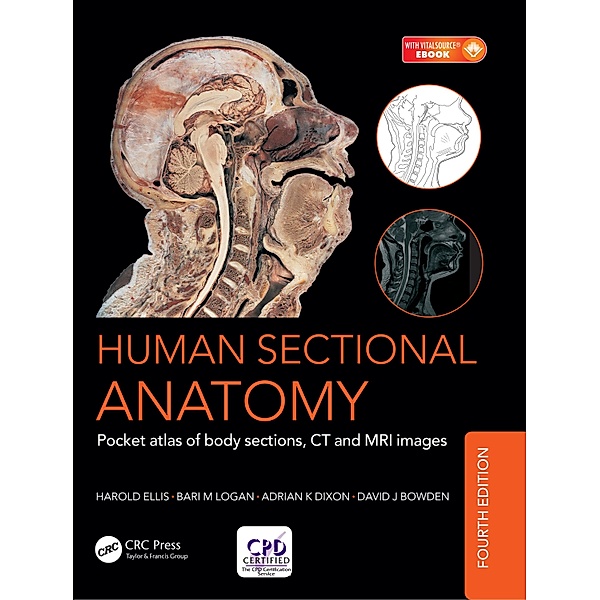 Human Sectional Anatomy, Adrian Kendal Dixon, David J. Bowden, Bari M. Logan, Harold Ellis