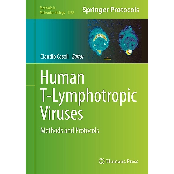 Human T-Lymphotropic Viruses / Methods in Molecular Biology Bd.1582