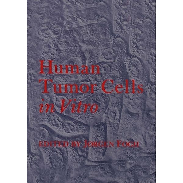 Human Tumor Cells in Vitro