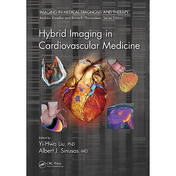 Hybrid Imaging in Cardiovascular Medicine