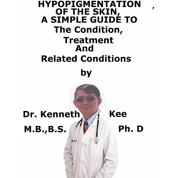 Hypo-Pigmentation Of The Skin A Simple Guide To The Condition, Treatment And Related Conditions, Kenneth Kee