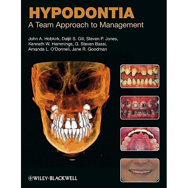 Hypodontia, John A. Hobkirk, Daljit S. Gill, Steven P. Jones, Kenneth W. Hemmings, G. Steven Bassi, Amanda L. O'Donnell, Jane R. Goodman