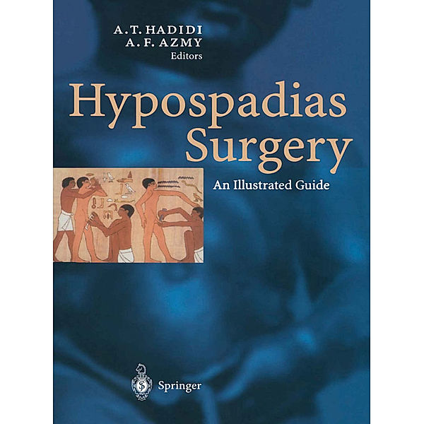 Hypospadias Surgery